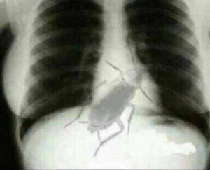 radiografie gandac
