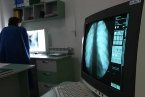 spitale-aparatura-medicala-radiografie.6b9xmpirch