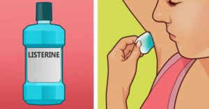 listerine